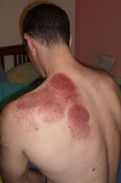 There, now. Doesn't that feel better?